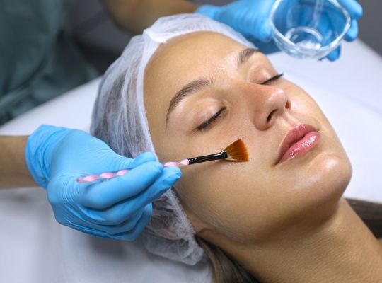 Acne and Scars treatment