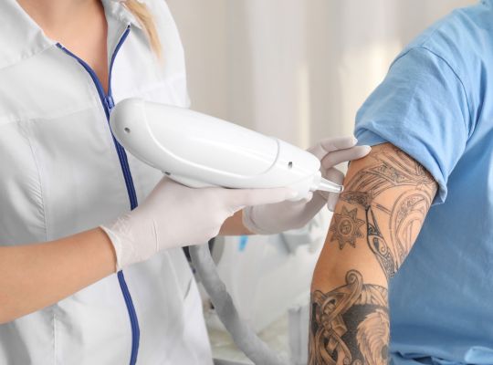 Tattoo Removal Treatment